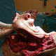 Illustration for article titled Reddit User Documents Facial Transplant in Photos (WARNING: GRAPHIC)
